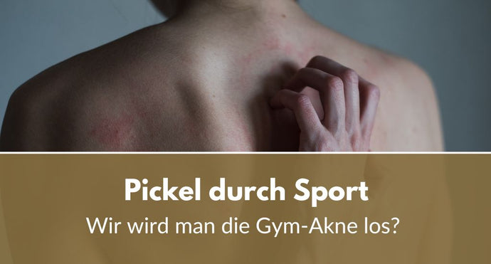 Pickel durch Sport: Wie wird man die “Gym-Akne” los?