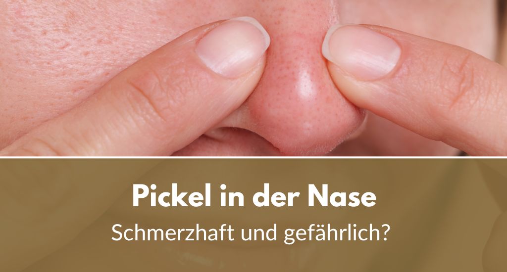 Pickel in der Nase: Nur schmerzhaft oder auch gefährlich?