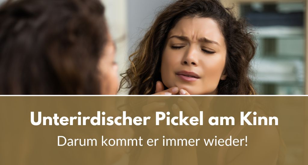 Unterirdischer Pickel am Kinn Darum kommt er immer wieder!