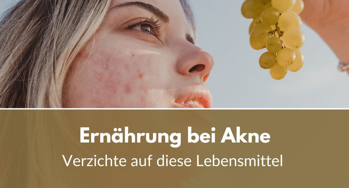 Ernährung bei Akne: Verzichte auf diese Lebensmittel