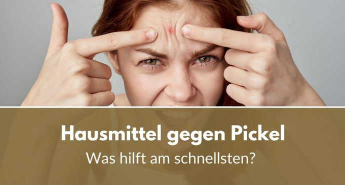 Hausmittel gegen Pickel: Was hilft am schnellsten?