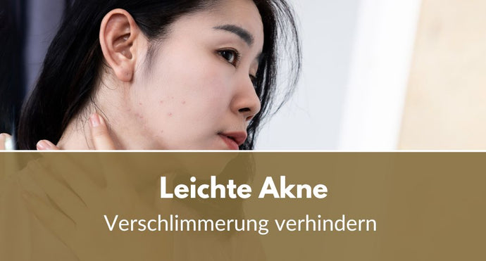 Leichte Akne: Wie verhindert man eine Verschlimmerung?