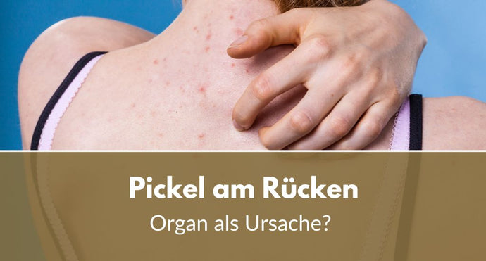 Pickel am Rücken: Dieses Organ ist die Ursache für Bacne
