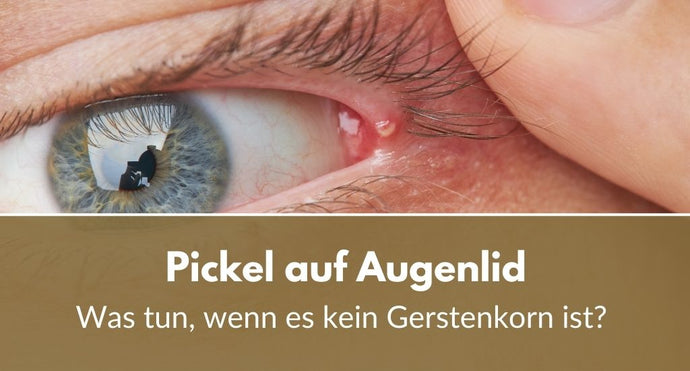 Pickel auf Augenlid: Was tun, wenn es kein Gerstenkorn ist?