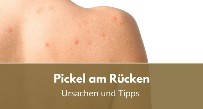 Pickel am Rücken: Die wahren Ursachen und effektive Tipps