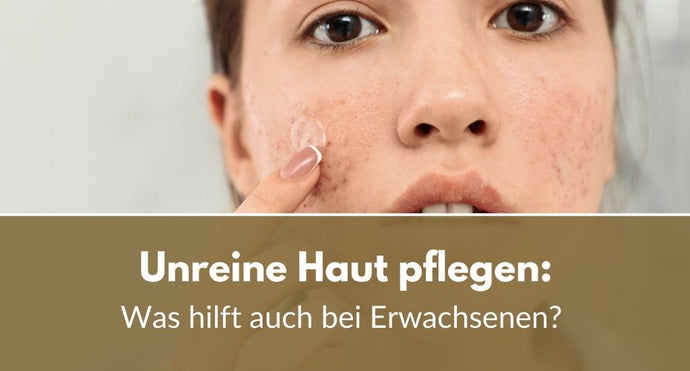 Unreine Haut pflegen: Was hilft auch bei Erwachsenen?